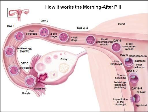morning_after_pill_process_large